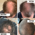 Regrow  Shampoo For Men