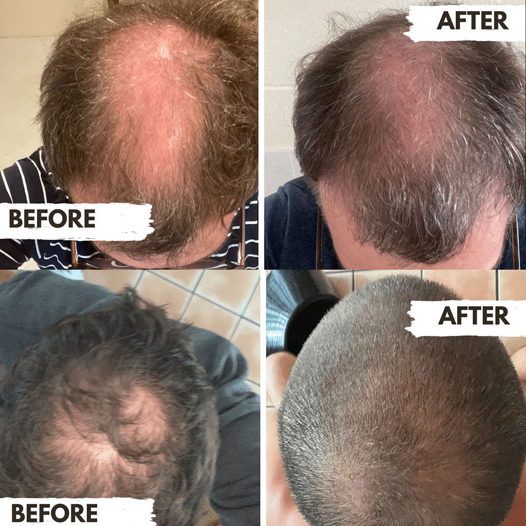Regrow  Shampoo For Men